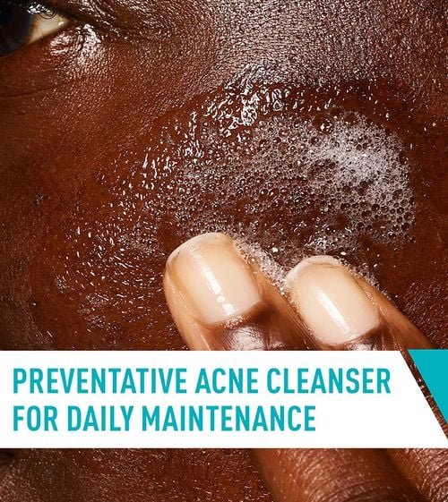 CeraVe Acne Control Cleanser back